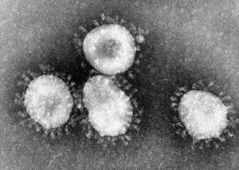 Godz. 8.45: Wykryli wirusa u pięciu osób z naszego regionu - Zdjęcie główne
