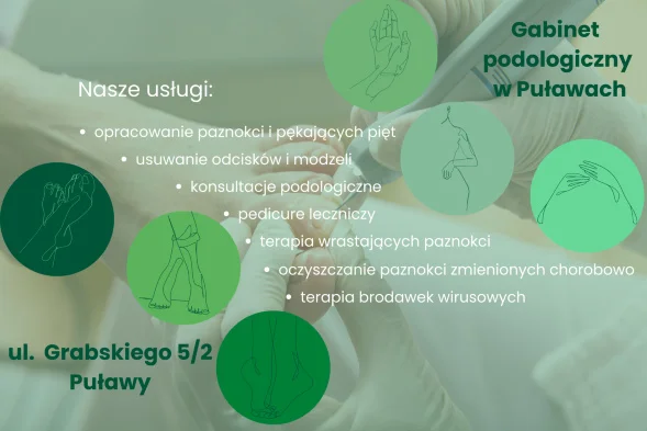 Zdrowa stopa, czyli wizyta u Podologa w Puławach - Zdjęcie główne