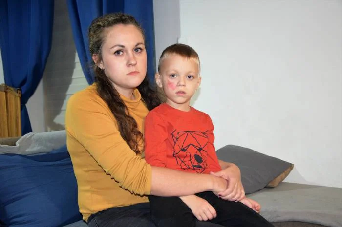 Rozkopaczew: "Syn piszczał w nocy, gdy pękały pęcherze"  - opowiada mama poparzonego chłopca - Zdjęcie główne