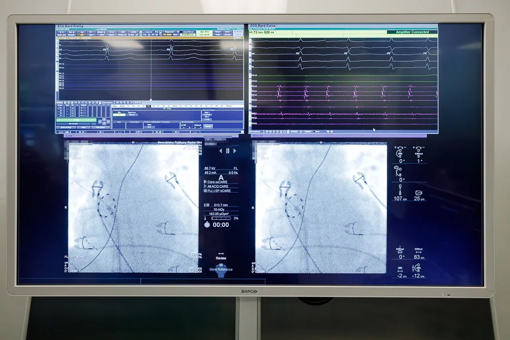 Lubelscy kardiolodzy pionierami w leczeniu arytmii serca. Wdrożyli nową metodę