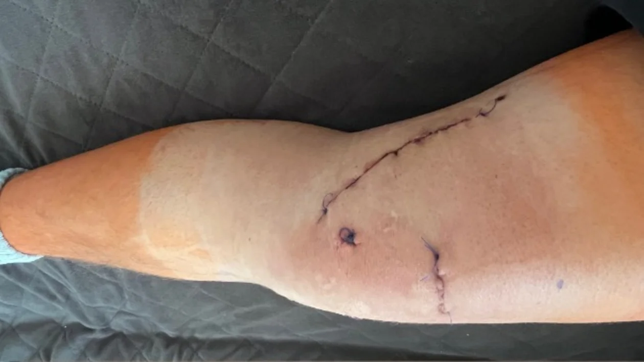 Dramatyczny widok od piłkarza Orionu - Zdjęcie główne