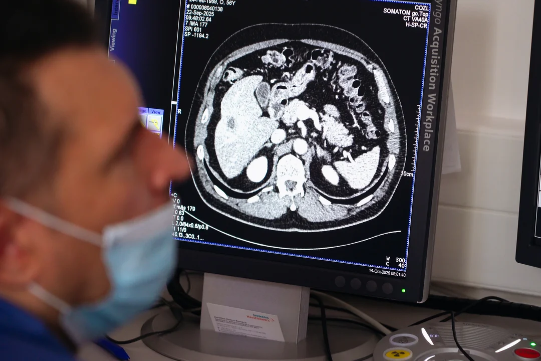 Lubelska onkologia podnosi poprzeczkę. Po milionowej inwestycji zwiększy się dostęp do terapii