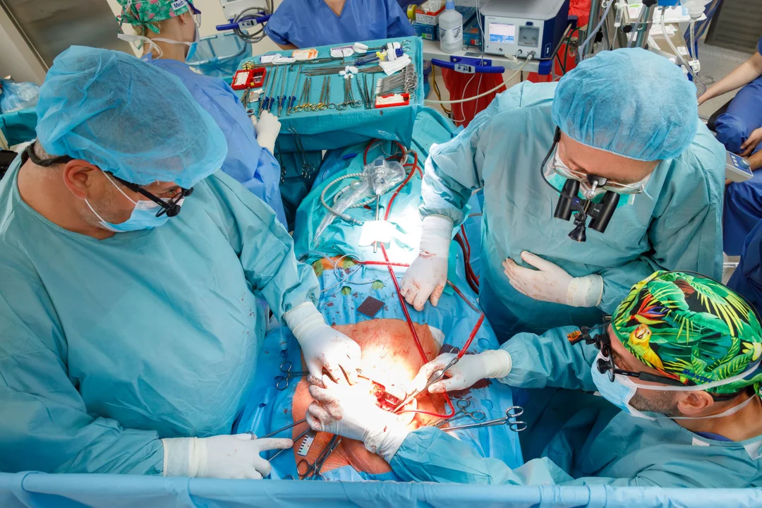 Lubelski szpital przeprowadził pierwszą taka operację. To szansa dla pacjentów z problemami z sercem - Zdjęcie główne