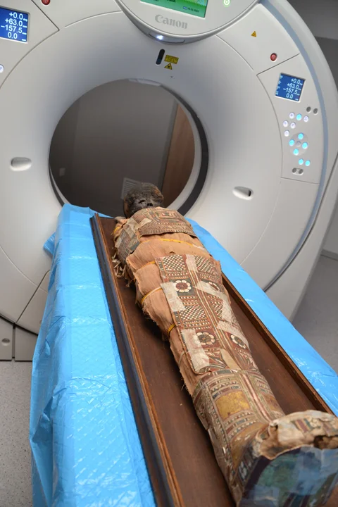 Radiolodzy z lubelskiego szpitala prześwietlili egipską mumię. Rozwiązali zagadkę sprzed 2 tys. lat