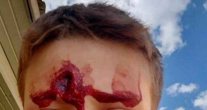 Co ze skatowanym chłopcem z Aleksandrowa? Matka broni napastnika. Szczegóły tylko w Nowej Gazecie Biłgorajskiej - Zdjęcie główne