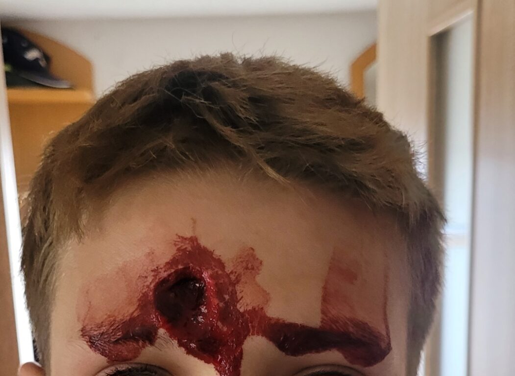 Brutalne sceny w Aleksandrowie. Wygryzł koledze ... skórę na czole. Szczegóły tylko w Nowej Gazecie Biłgorajskiej - Zdjęcie główne