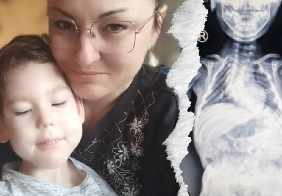 Lekarze zmienili zdanie?! Kubuś z Biłgoraja walczy o życie - Zdjęcie główne