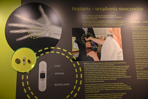 NBP reklamuje na swojej stronie podskórny implant płatniczy - Zdjęcie główne